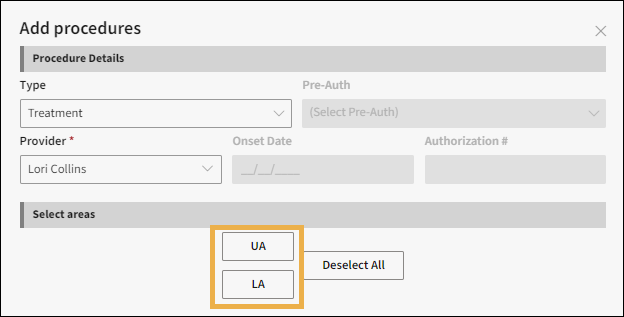 Add procedures window with yellow highlight around the select areas buttons.